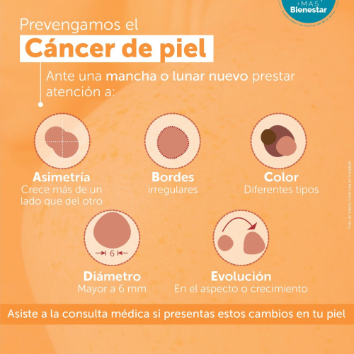 Distrito invita a las y los bogotanos a prevenir el cáncer de piel​​