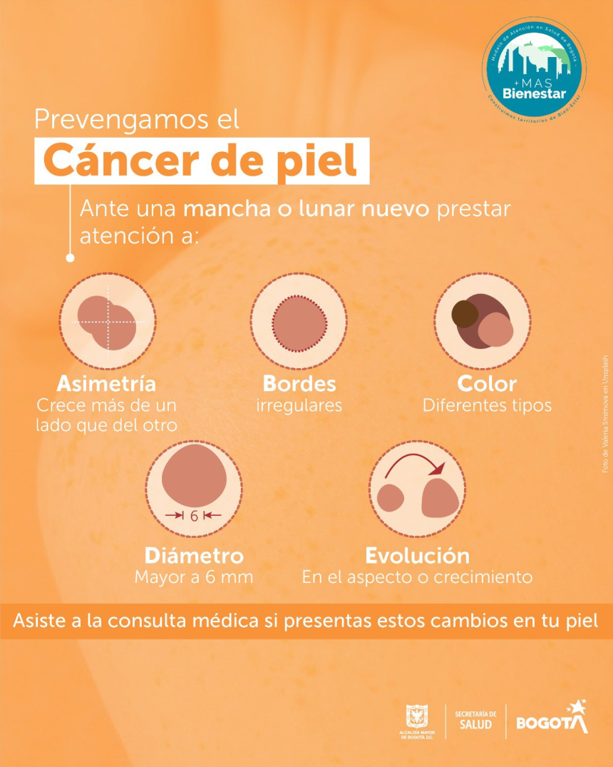 Distrito invita a las y los bogotanos a prevenir el cáncer de piel​​