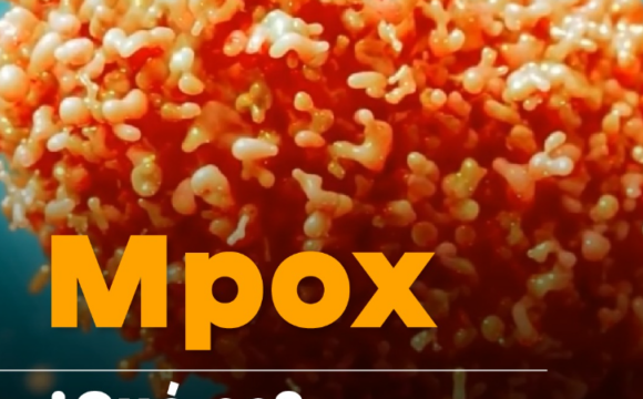 Mpox Variante Mpox
